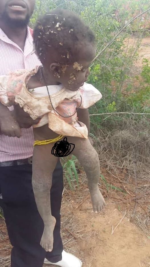 10-Month-Old Baby Girl Rescued After Being Buried Alive By Her Mother [Photos] 2