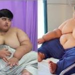 World’s Fattest Child Who Is 10 Years Old Set To Undergo Weight Loss Surgery [Photos] 3
