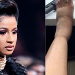 Cardi B Regrets Plastic Surgery, Shares Shocking Photos Of Swollen Feet As Side Effect 6