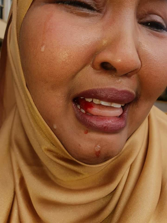 Female Lawmaker Cries Bitterly After She Was Beaten Up By Male Colleague At Parliament Building 6