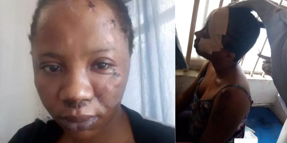 “‘I Wouldn’t Have Made It” – Lady Shares Near Death Experience With One-chance Operators