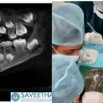 Doctors Shocked As They Remove 526 Teeth From Mouth Of 7-Year-Old Boy [Photos] 5
