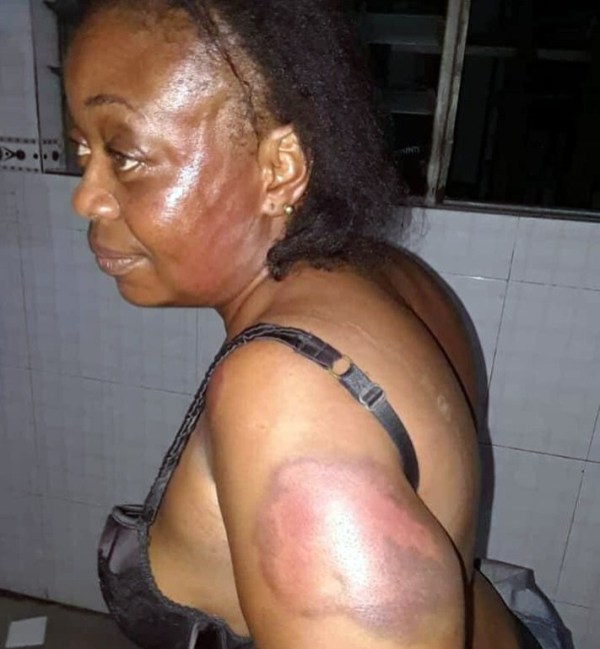 Nigerian Lawmaker Beats Up Married Woman, Forces Her To Walk & Dance Naked In Public 2