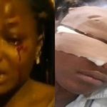 I Was Assaulted By Policemen For Refusing Them Sex – Brutalised FUTA Student [Video] 4