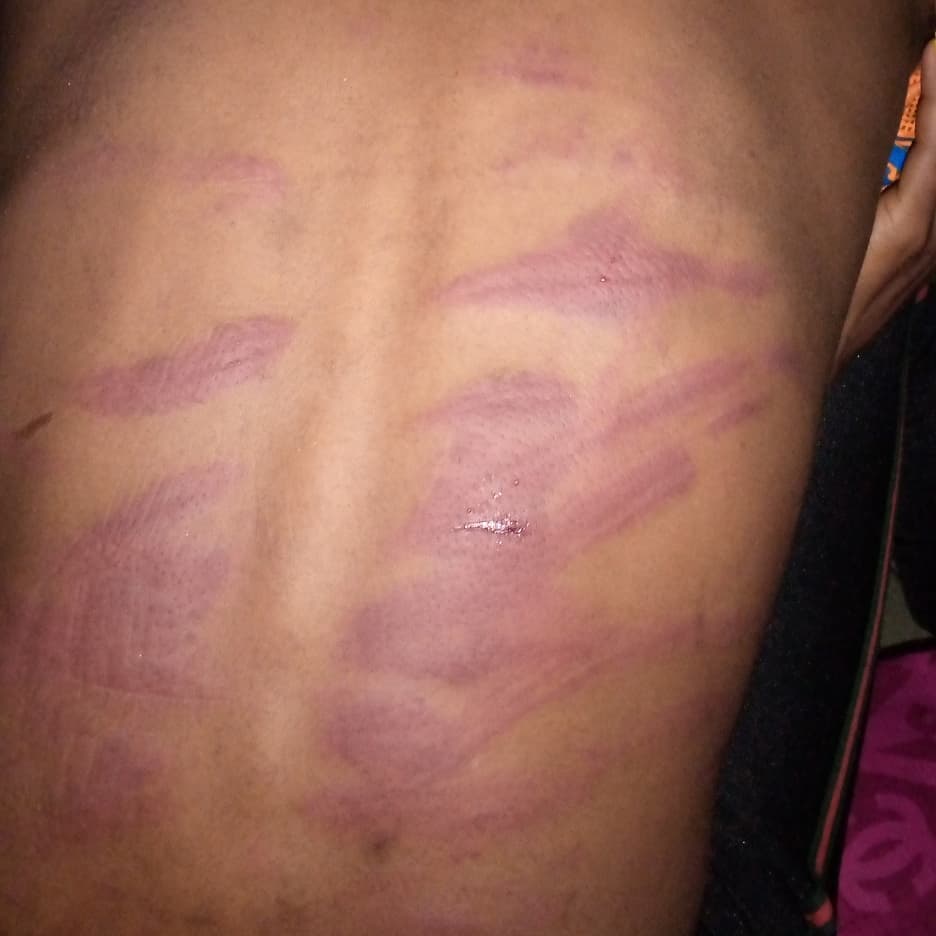 Young Lady Mercilessly Beaten By Her Mom Because She Went Out To Make Her Hair [Photos] 3