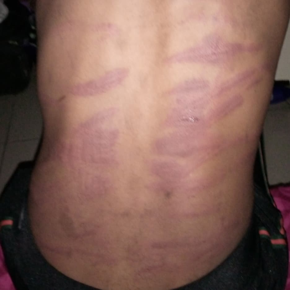 Young Lady Mercilessly Beaten By Her Mom Because She Went Out To Make Her Hair [Photos] 5