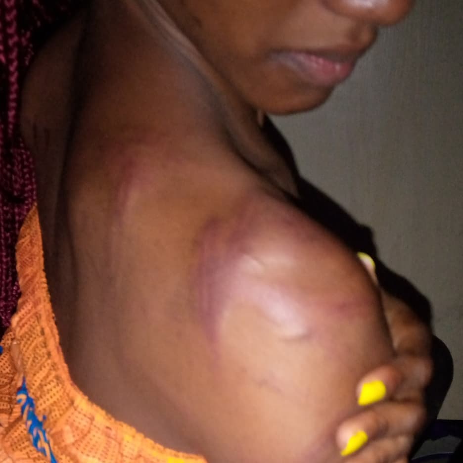 Young Lady Mercilessly Beaten By Her Mom Because She Went Out To Make Her Hair [Photos] 4