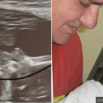 Pregnant Woman Claims Her Late Father's Ghost Is Kissing Her Unborn Daughter In Ultrasound 2