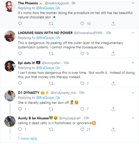 Nigerians React To New 'Instant Skin Bleaching' Procedure That Women Are Now Doing [Video] 10