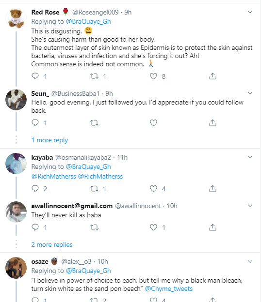 Nigerians React To New 'Instant Skin Bleaching' Procedure That Women Are Now Doing [Video] 13