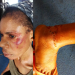 Police DPO Beats And Strips 2 Sisters Naked, Then Arrests Their Widowed Mother In Delta 3
