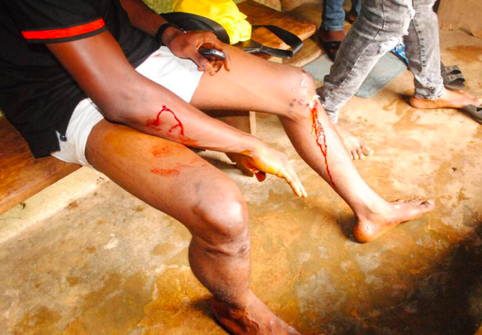 Ondo Guber Election: APC Thugs Attacks Governor Akeredolu's Supporters, Several Injured [Photos] 3