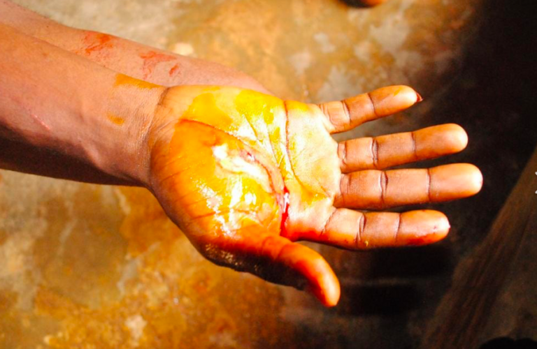 Ondo Guber Election: APC Thugs Attacks Governor Akeredolu's Supporters, Several Injured [Photos] 4