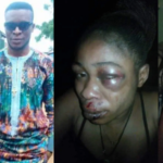 Man Brutalizes His Wife For Refusing To Abort Her Three-Month-Old Pregnancy In Ondo State [Photos] 3
