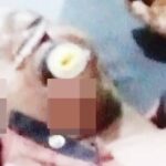 20-Year-Old Man Battles For His Life After Being Attacked By Bribe-Seeking Policeman In Osun 6