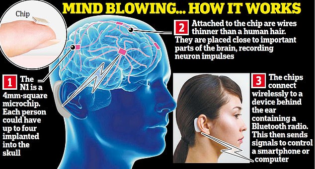 Elon Musk's Neuralink Launches Brain-Monitoring Implant, Demonstrates How It Works Using Pigs 6