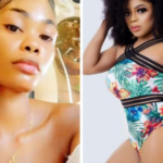 Ivorian Lady Oye Kyme Whom Bobrisky Took In After She Tattooed His Name On Her Body Accuses Him Of Assault. 2