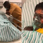 Man Bathes His Wife With Acid After Throwing Her Out Of His House [Photos/Video] 3