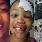 Man Removes Girlfriend’s Teeth After She Destroyed His House For Cheating [Photos]