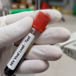 New York Patient Becomes First Woman To Be Cured Of HIV Using Novel Treatment