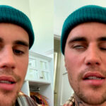 Justin Bieber Diagnosed With A Rare Syndrome Which Paralyzed Half Of His Face [Video]