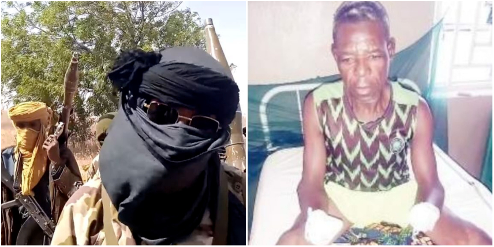 30-Year-Old Man Begs For Artificial Arms After Being Attacked By Bandits In Zamfara