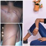 Nigerian Woman Dumps Husband After Beating Her Like A 'Common Criminal'