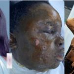 Cameroonian Lady Allegedly Pours Hot Oil On Her Colleague's Face After A Fight In Cyprus