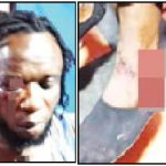 Ebonyi Musician Beaten To Pulp By Governor Umahi's Aide Over Campaign Song 3 Ebonyi Musician Beaten To Pulp By Governor Umahi's Aide Over Campaign Song