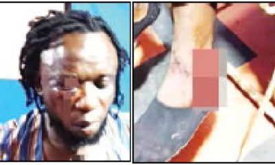 Ebonyi Musician Beaten To Pulp By Governor Umahi's Aide Over Campaign Song