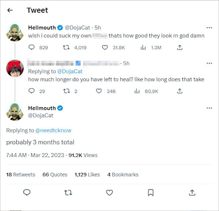 Doja Cat Speaks Out After Undergoing Breast Reduction Surgery And Liposuction