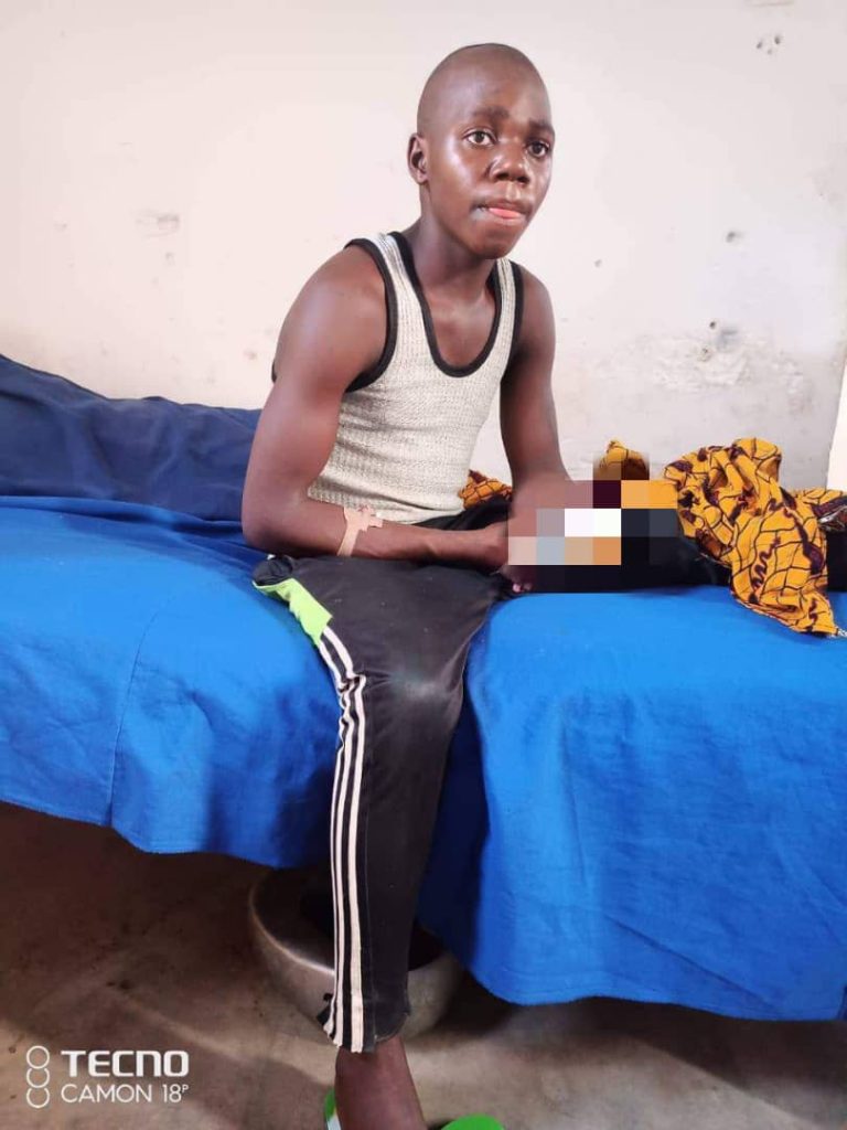 19-Year-Old Kaduna Boy Recounts How Bandits Cut Off His Arm Despite N1m Ransom 1 bandits attack victim, Zakaria Iliya