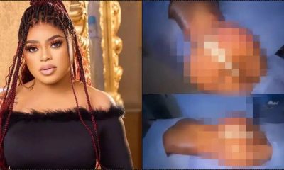 “I Pray These Bruises Clear” - Bobrisky Flaunts His New Backside With Scars After BBL Surgery [Video]