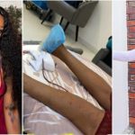 "If Anything Happens To Me, Hold This Surgeon Responsible" - Nigerian Transgender, Jay Boogie