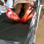 Man Allegedly Machetes Lover For Failing To Visit on Valentine’s Day 2