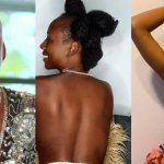 Nigerian dancer Korra Obidi stabbed and attacked with acid 1