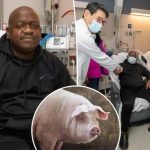 Man Who Received First-Ever Kidney Transplant Dies Weeks After Surgery