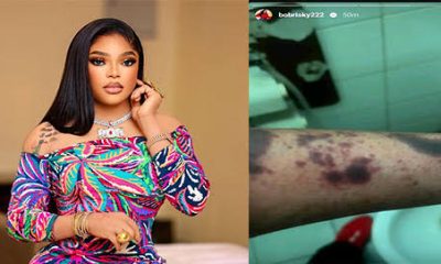 “Nigerians Help Me, I’m Badly Injured” – Bobrisky Cries Out As EFCC Confirms His Arrest