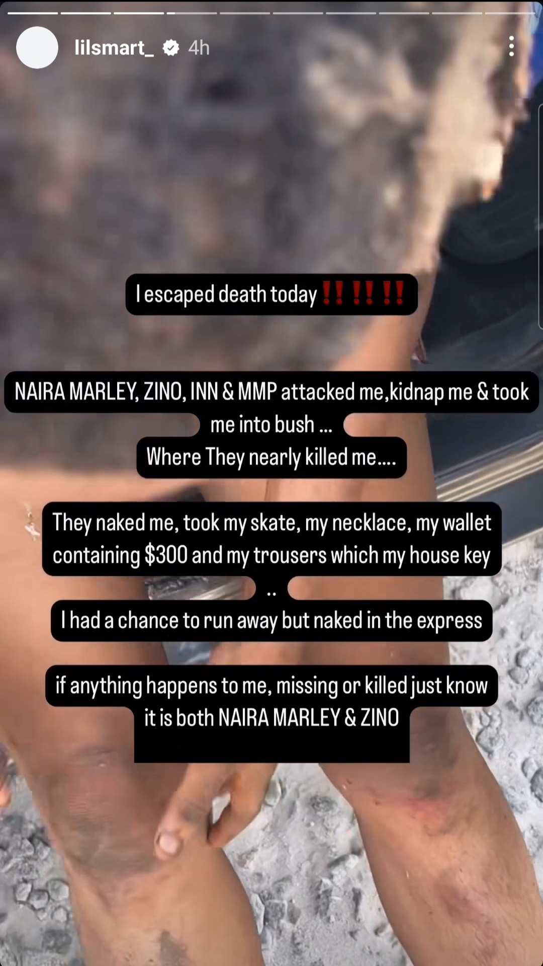"Naira Marley & Zinoleesky Kidnapped And Almost Killed Me" - Lil Smart Cries Out