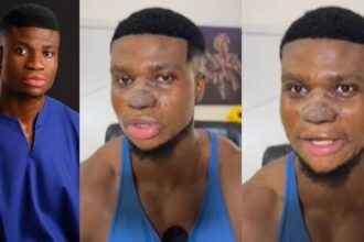 "I Love My New Look, I'm Better Than Most Of You" – Zicsaloma Says After Nose Surgery [Video]