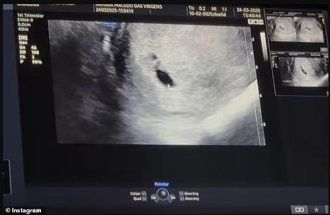 Brazilian Escort 'Who Got Pregnant After Threesοme With Neymar' Reveals Baby’s Gender