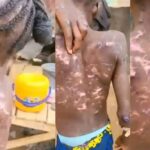 Abuja CP Orders Arrest Of Woman For Alleged Abuse And Burning Of Maid