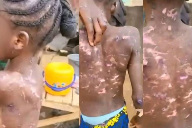 Abuja CP Orders Arrest Of Woman For Alleged Abuse And Burning Of Maid