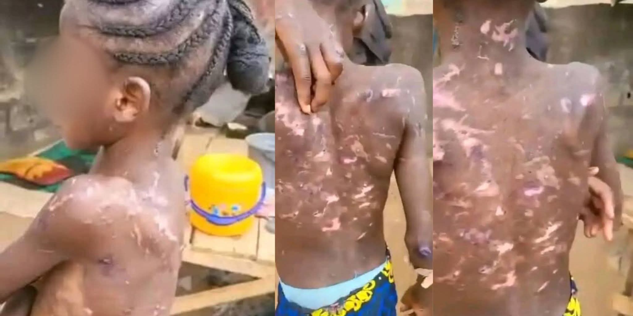 Abuja CP Orders Arrest Of Woman For Alleged Abuse And Burning Of Maid