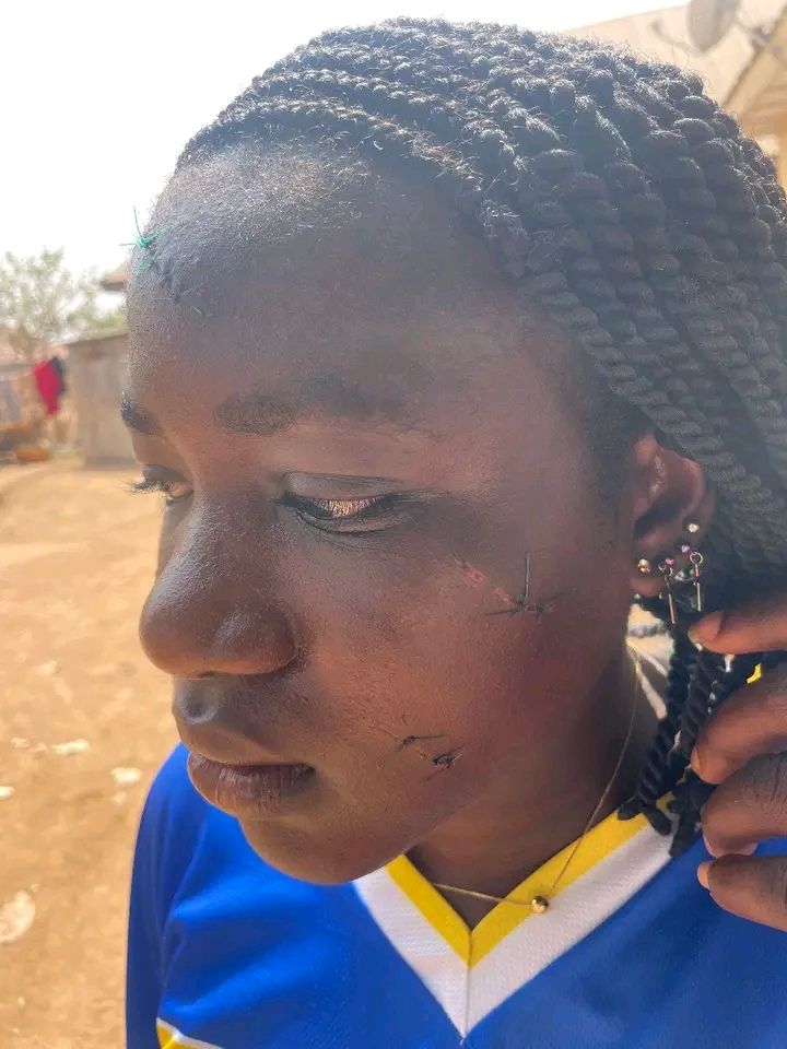 Taraba Govt Arrest Woman Who Attacked Teenager With Razor Over Alleged Affairs With Husband