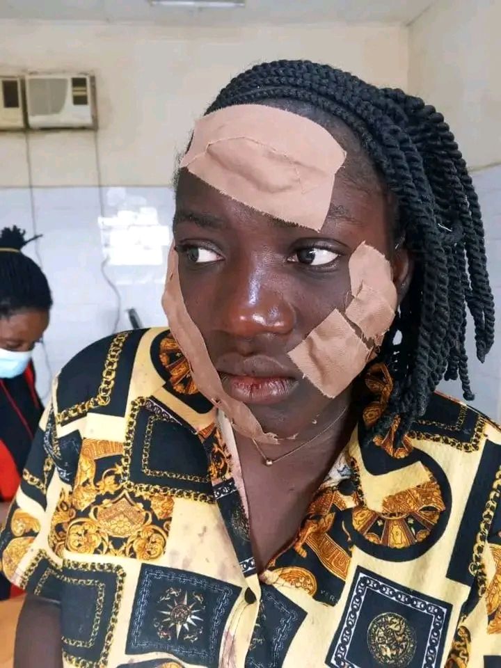 Taraba Govt Arrest Woman Who Attacked Teenager With Razor Over Alleged Affairs With Husband