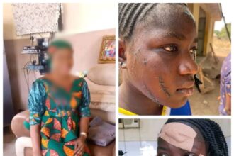 Taraba Govt Arrest Woman Who Attacked Teenager With Razor Over Alleged Affairs With Husband