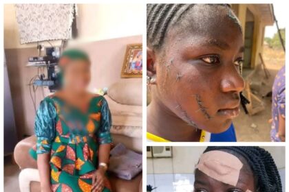 Taraba Govt Arrest Woman Who Attacked Teenager With Razor Over Alleged Affairs With Husband