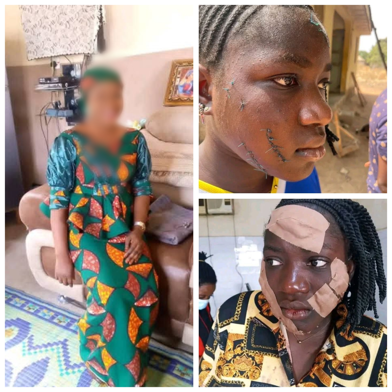Taraba Govt Arrest Woman Who Attacked Teenager With Razor Over Alleged Affairs With Husband