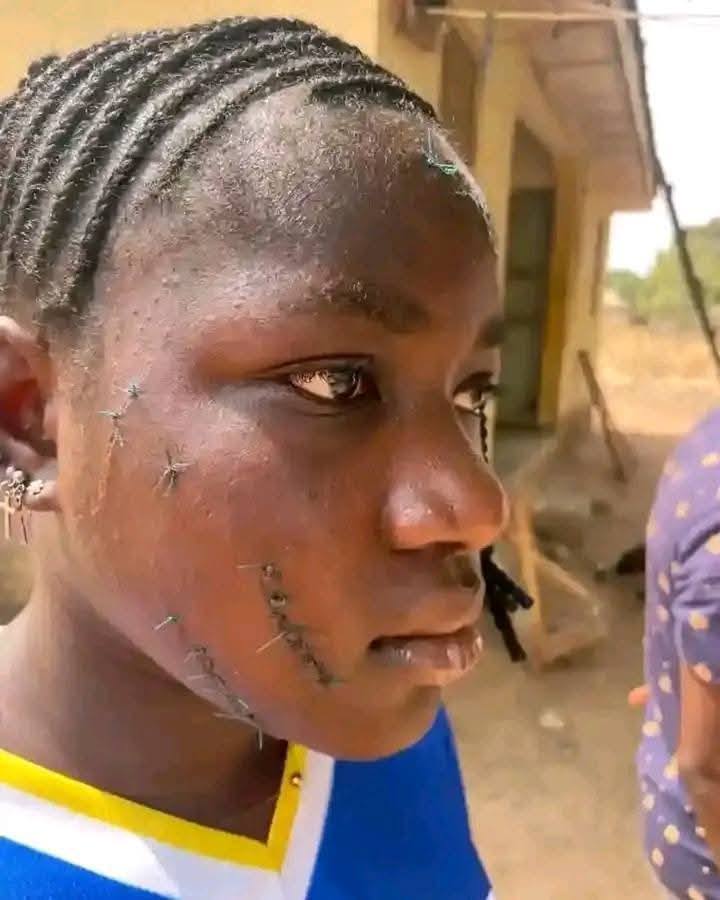 Taraba Govt Arrest Woman Who Attacked Teenager With Razor Over Alleged Affairs With Husband